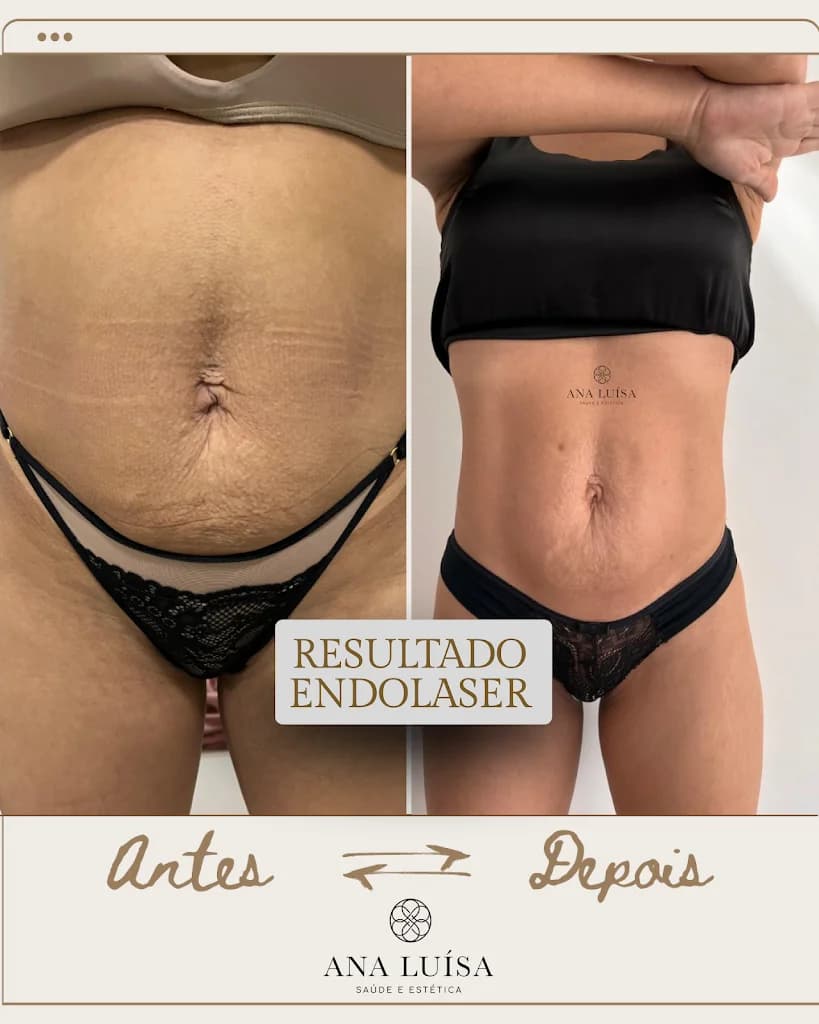 Ana Luisa | Saúde e Estética Avançada | Betim – foto 2
