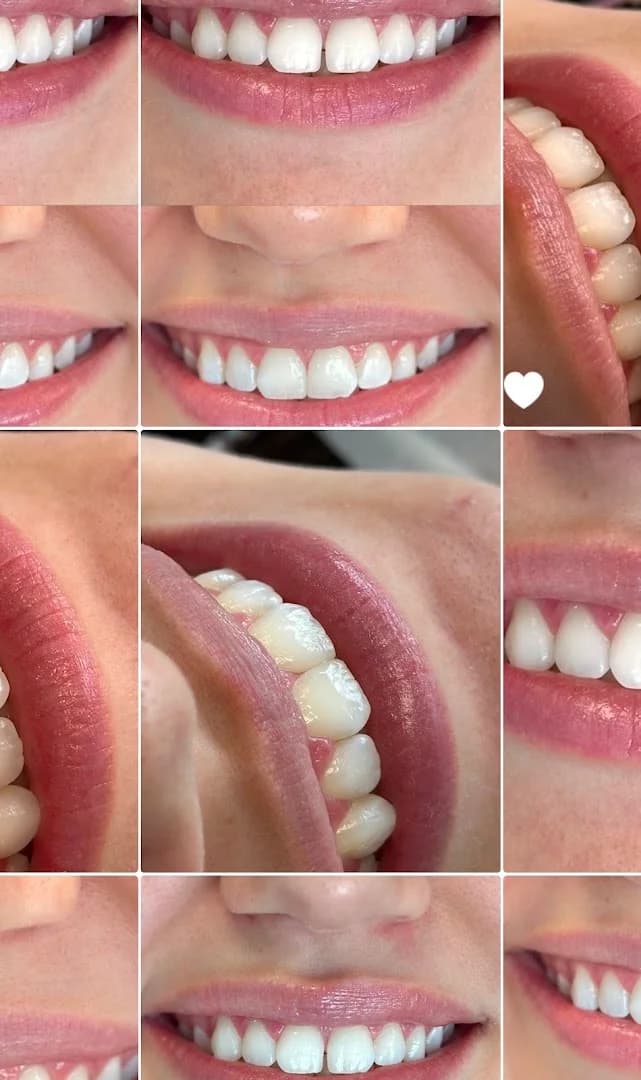 Dra Jéssica Soares | Consulta | Bruxismo | Facetas | Clareamento | Restauração | Revisão | Periodontia DENTISTA PORTO ALEGRE