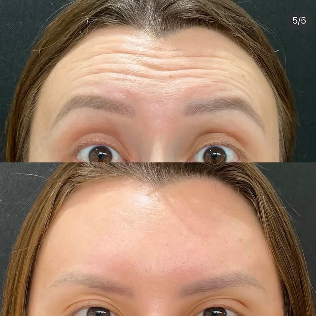 Dra. Tatiane de Liz | Harmonização Facial em Lages
