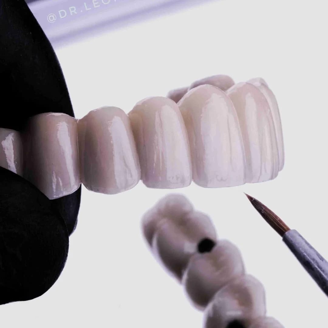Dr. Leonardo Blanco - Implante e estética Dental – foto 3