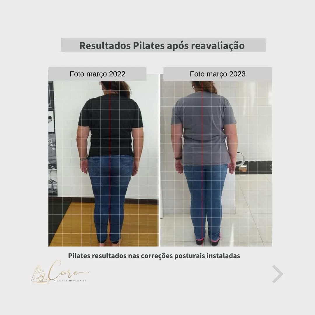 Rekintsu Pilates Clínico – foto 1