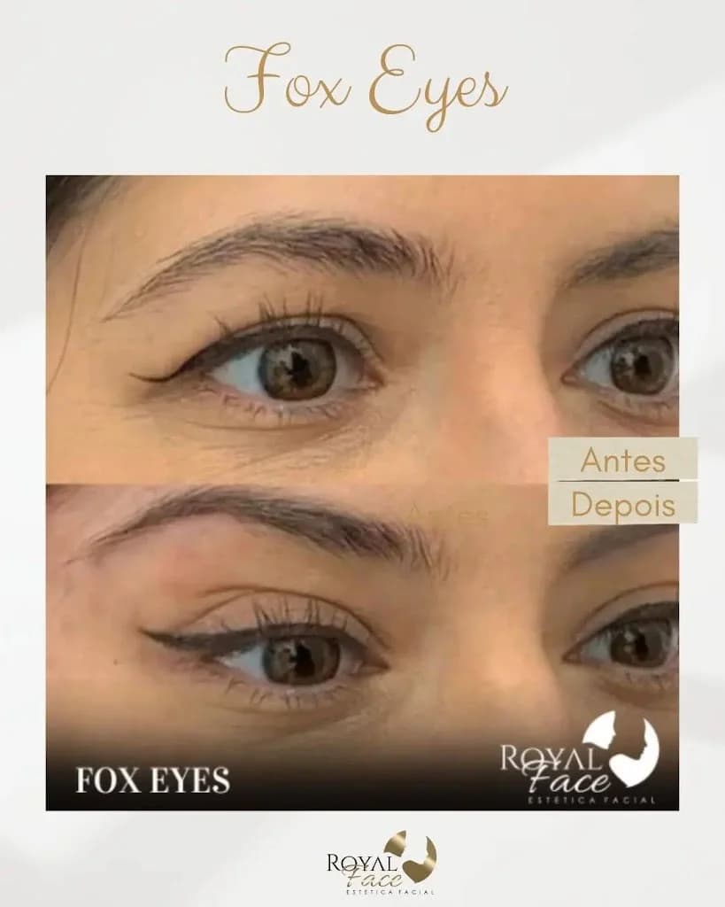 Royal Face Clínica de Estética - Castanhal – foto 2