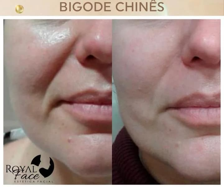Royal Face Clínica de Estética - Castanhal – foto 3