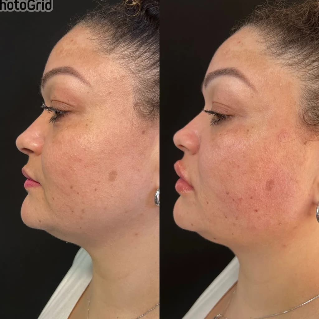 Clinica Estética Avançada | Dra. Daiana Roecker – foto 2