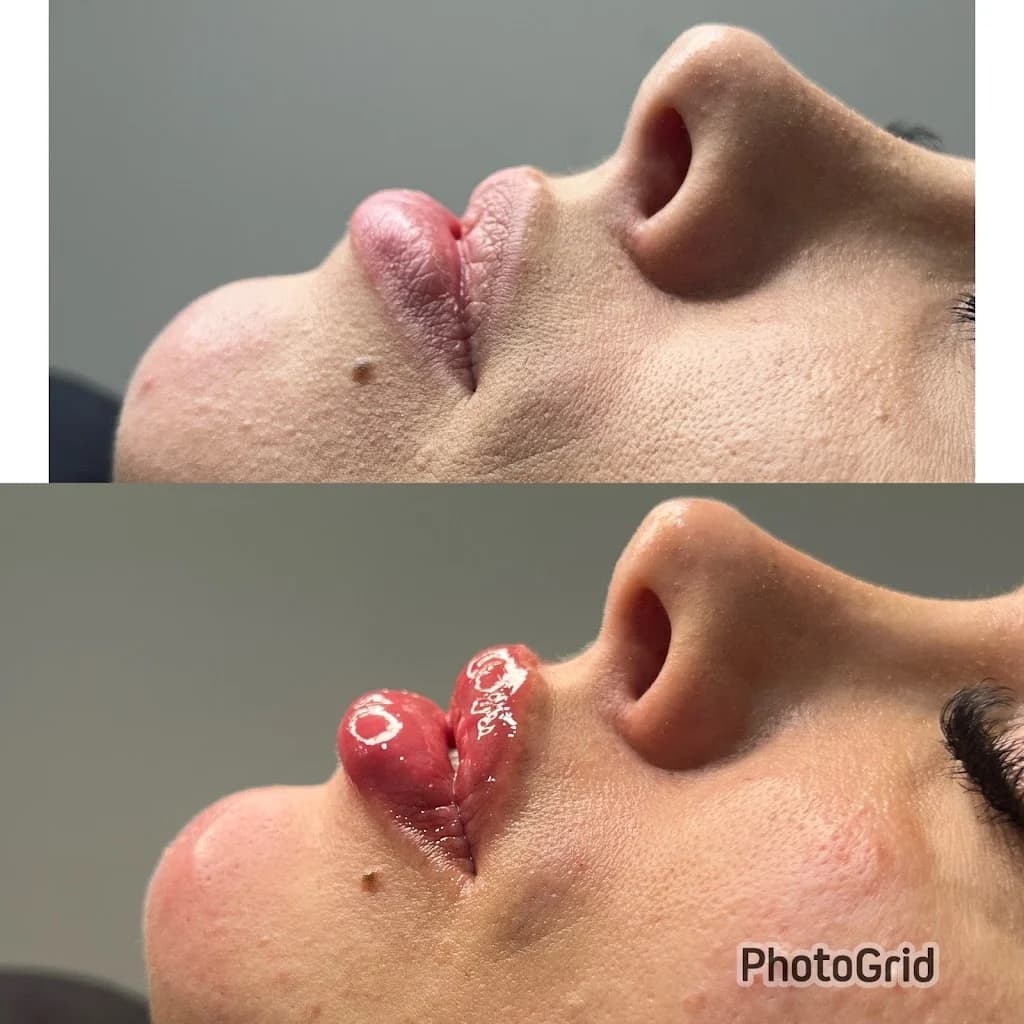 Clinica Estética Avançada | Dra. Daiana Roecker – foto 3