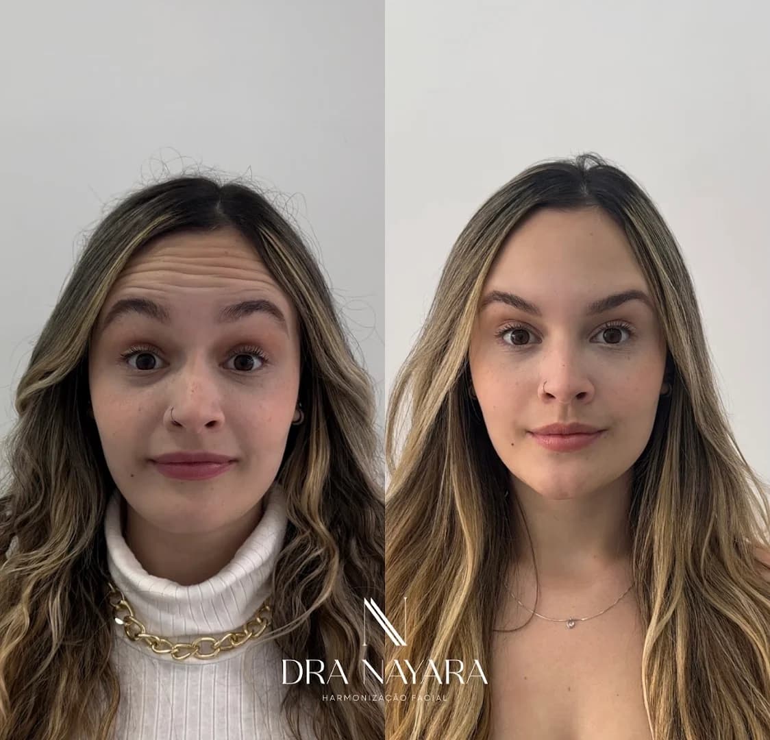 Dra Nayara Silva - Harmonização Facial
