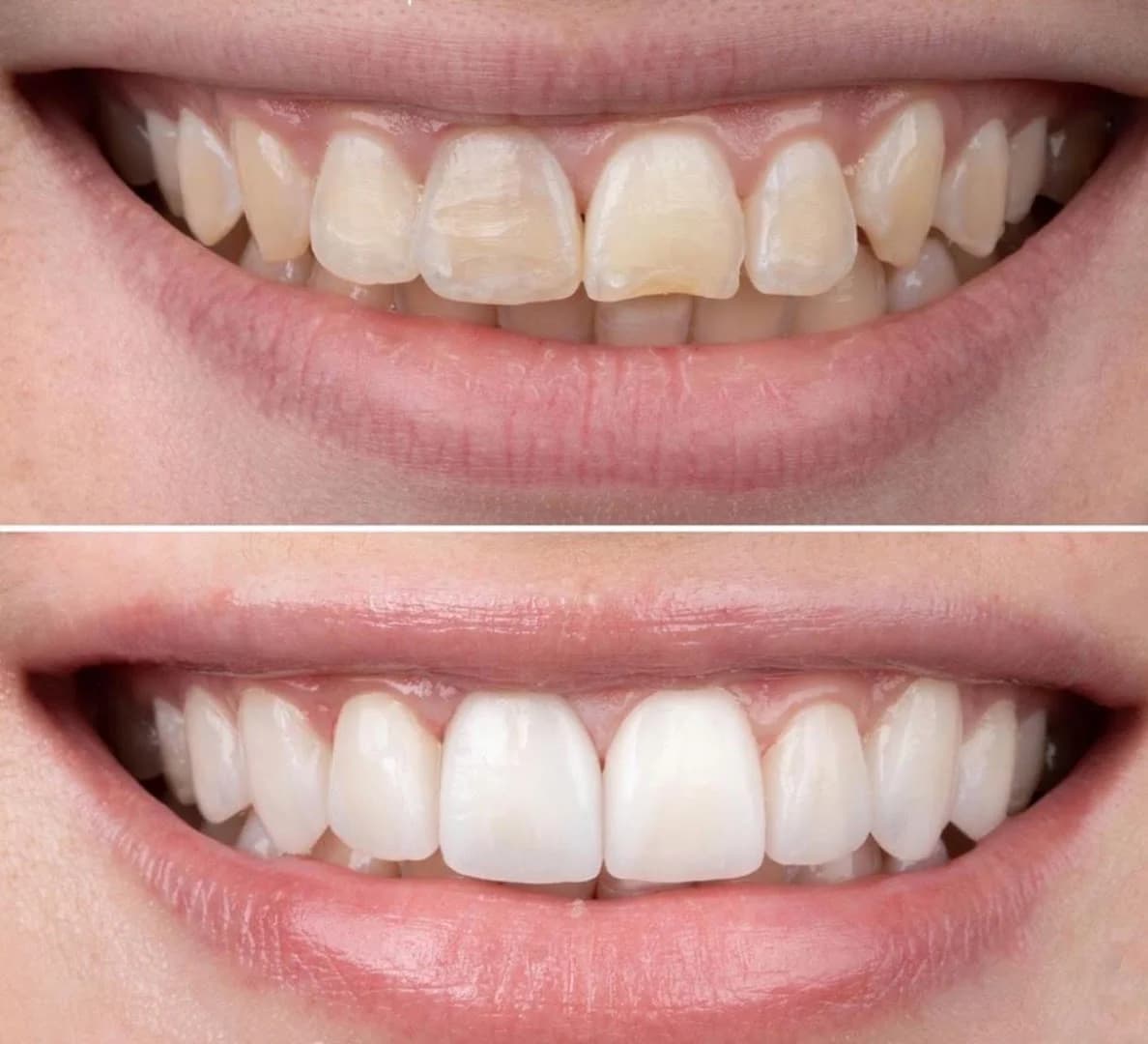 Clínica Odontologia Ioselli | Dra. Luciana Ioselli e Dr. Carlos Barros – foto 3