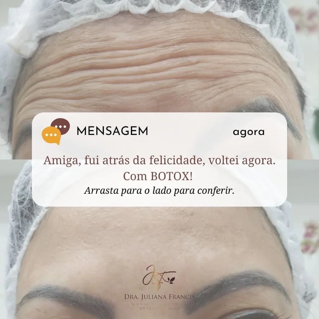 Botox | Harmonização Facial | Limpeza de Pele | Massagem Modeladora | Drenagem Linfática | Dra. Juliana Francis | Mauá – foto 3