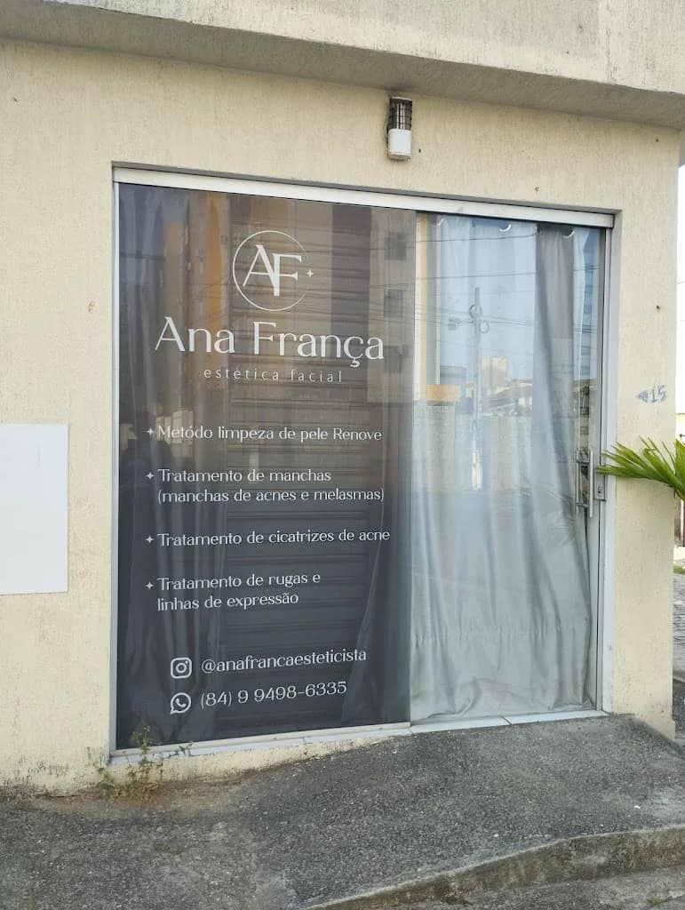 Ana França estetica - especialista em limpeza de pele, manchas e cicatrizes de acne NATAL/RN