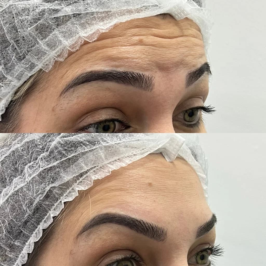 Dra. Caroline Cruz Estética Avançada - Harmonização Facial, Preenchimento Labial, Botox, Rinomodelação