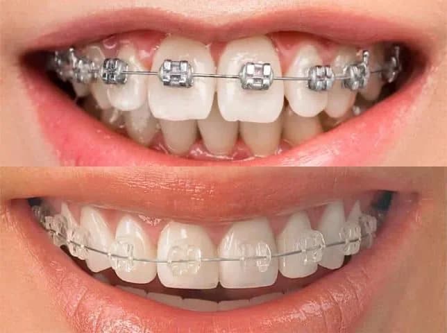 Odontoclinic - Parque das Nações – foto 3