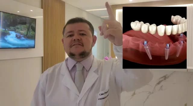 Implante Dental Campinas – foto 2