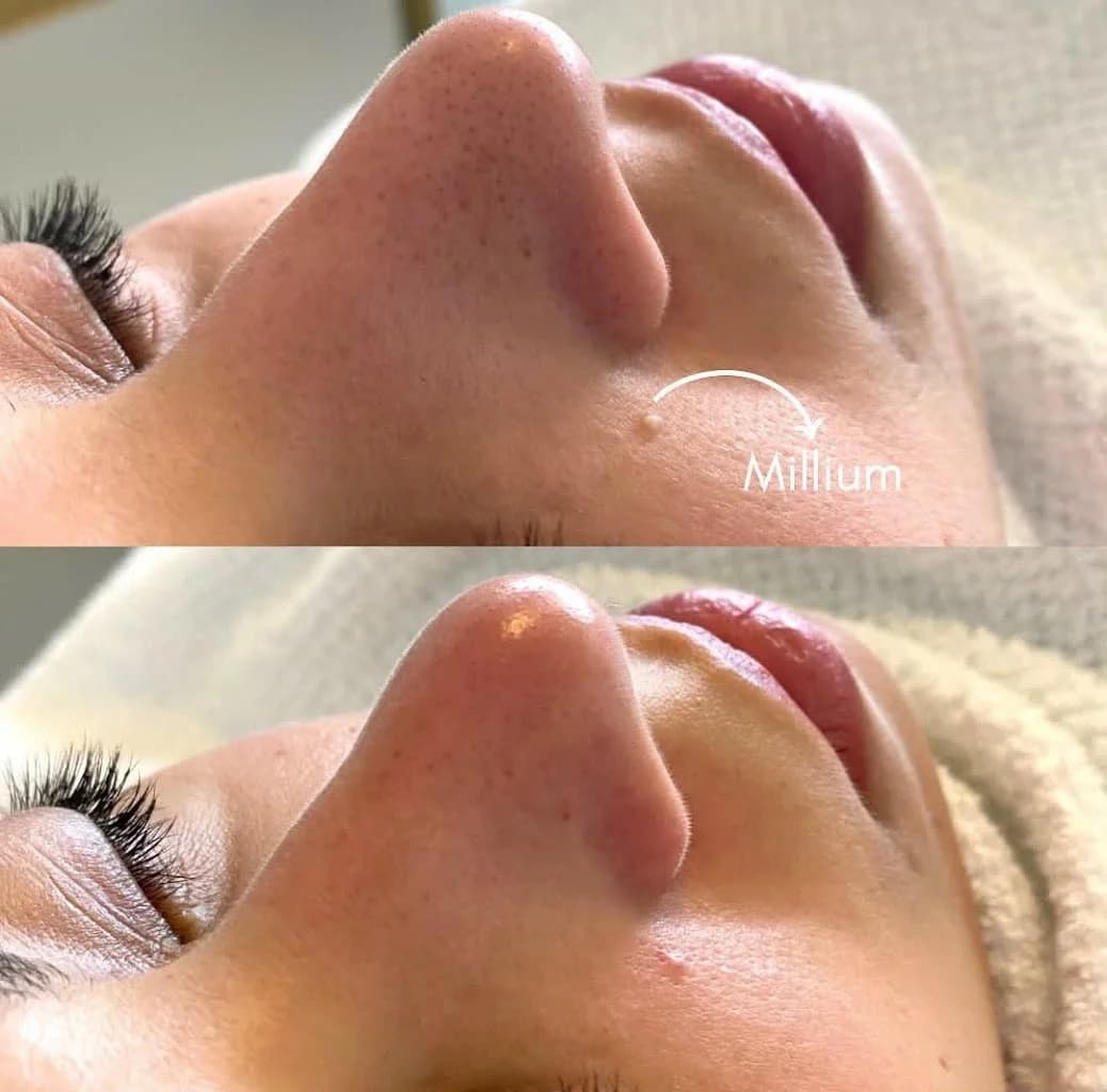 Clínica Estética Cássia Diaz - Limpeza de Pele, Massagem Relaxante Drenagem Linfática Indaiatuba. – foto 2