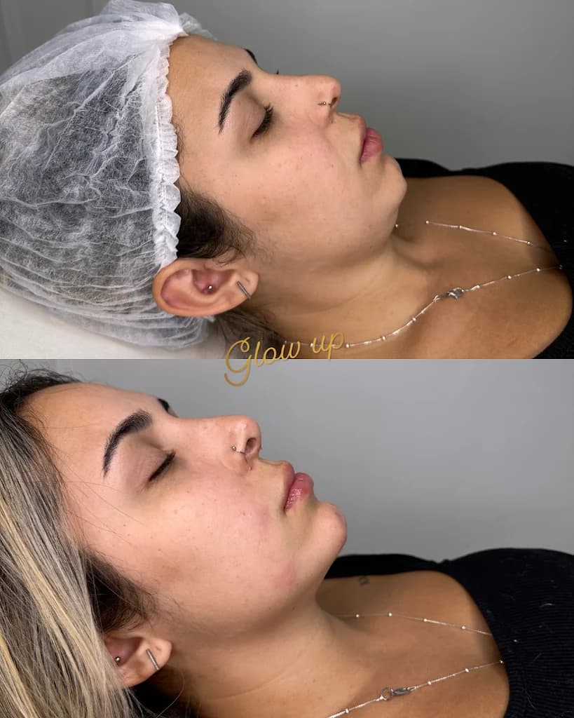 Glow Up Estética Avançada – foto 3