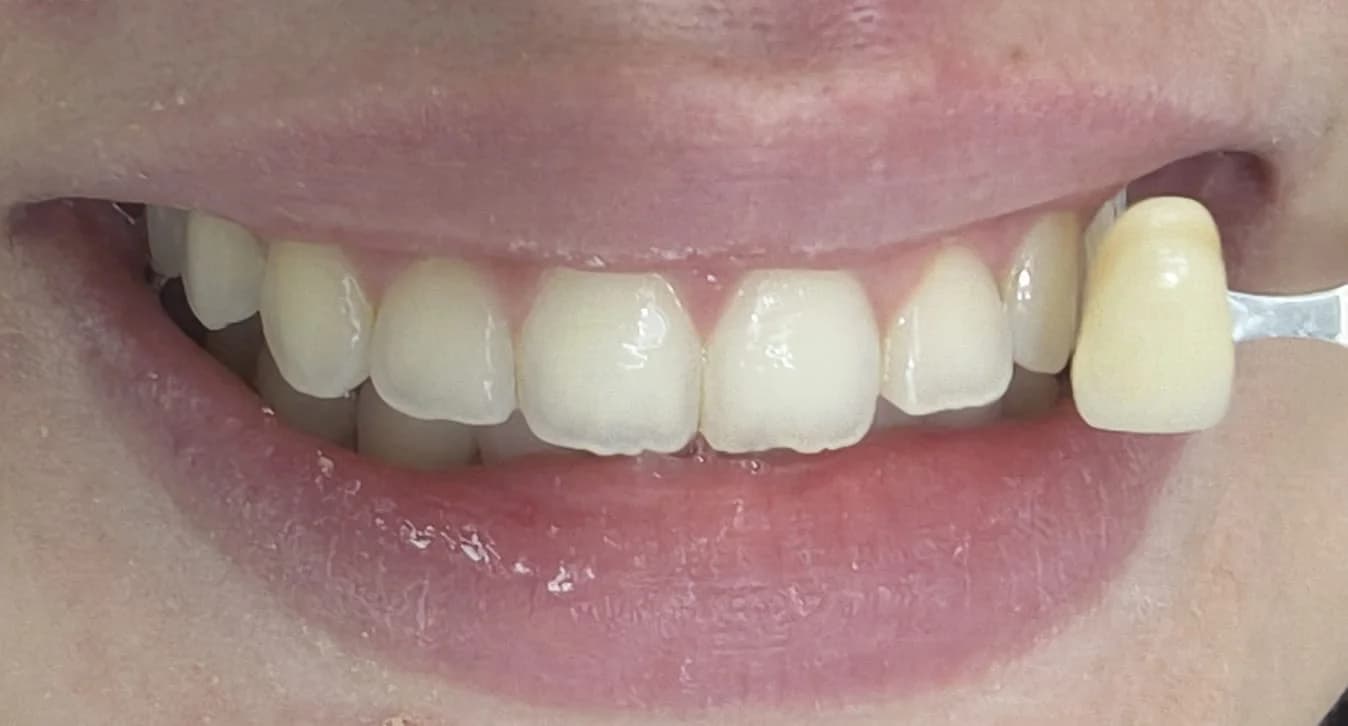 Dra. Melina Miranda | Dentista em Ribeirão Preto 24 horas – foto 3
