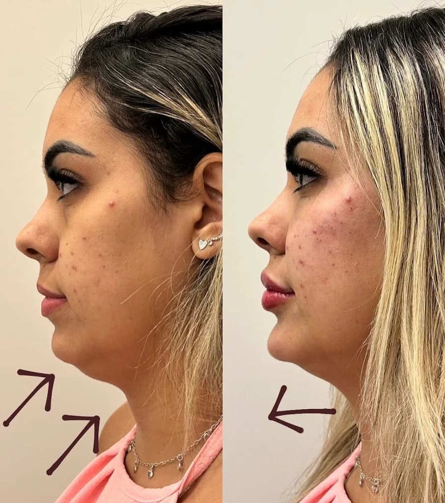 Dra Andressa de Paula | Harmonização | Estética Avançada – foto 3