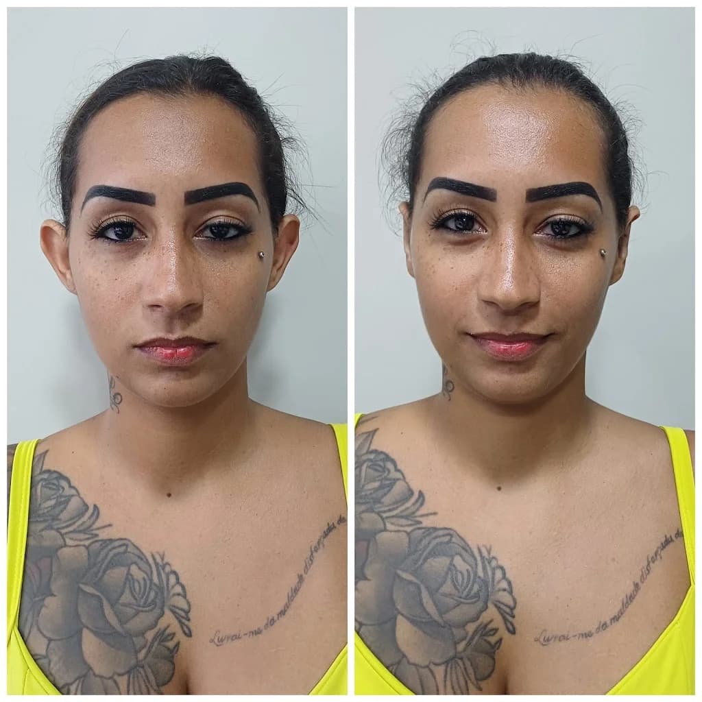 Dra. Gabriela Esteves - Otomodelação, botox , preenchimento , Harmonização Facial , Rinomodelação , lipo de papada – foto 3