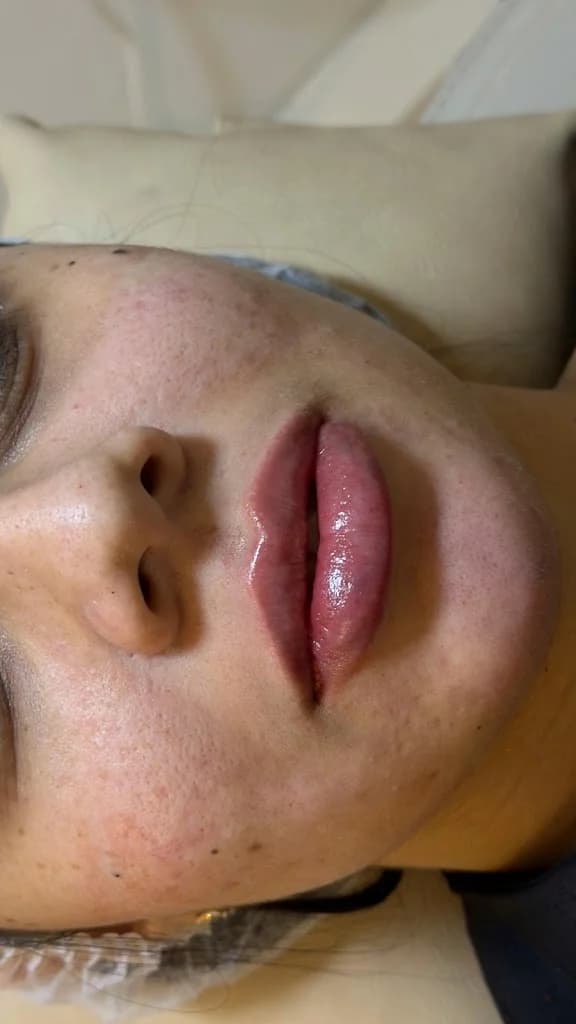 Dra Danielly Porto | Harmonização Facial em João Pessoa – foto 3