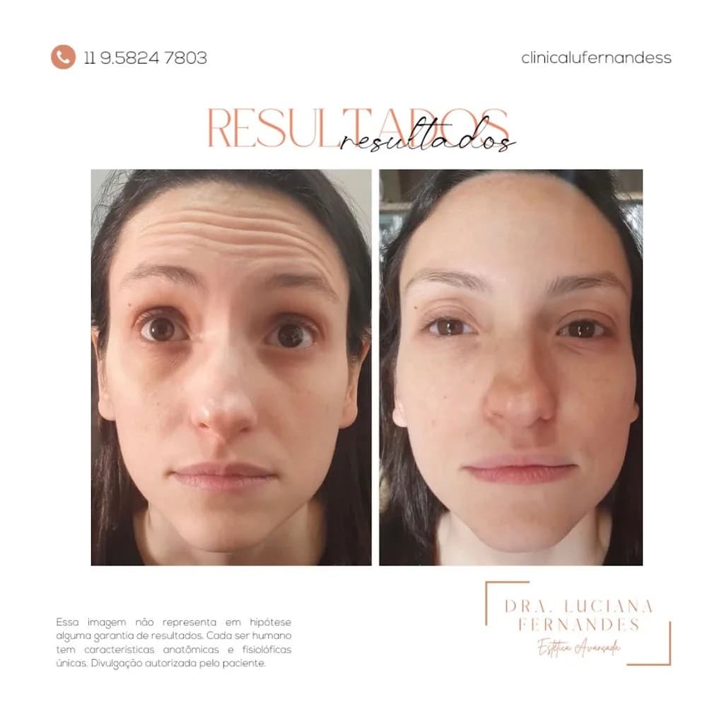Dra.Luciana Fernandes | Botox, Preenchimento Labial e Harmonização Facial – foto 1