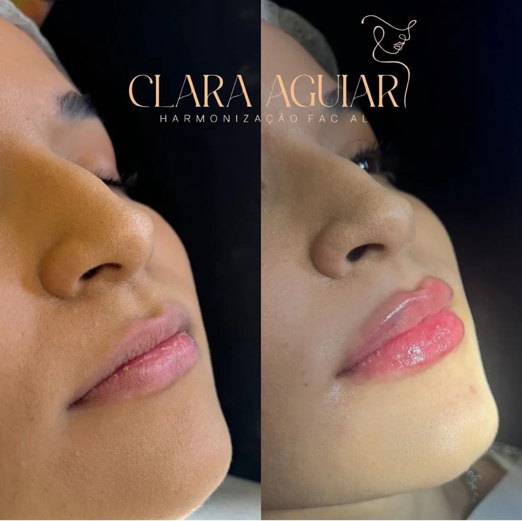 Drª Clara Aguiar - Harmonização Facial – foto 2