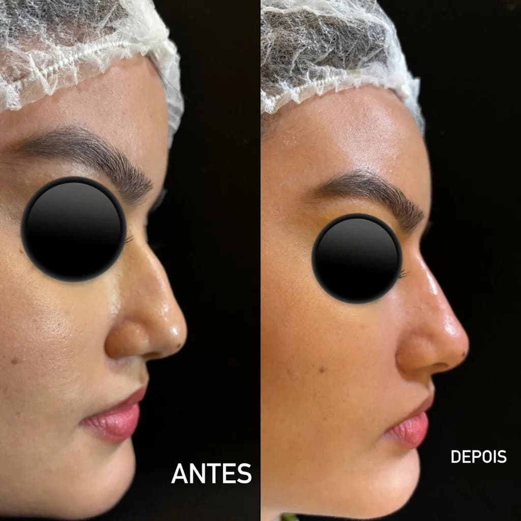 Drª Clara Aguiar - Harmonização Facial – foto 3