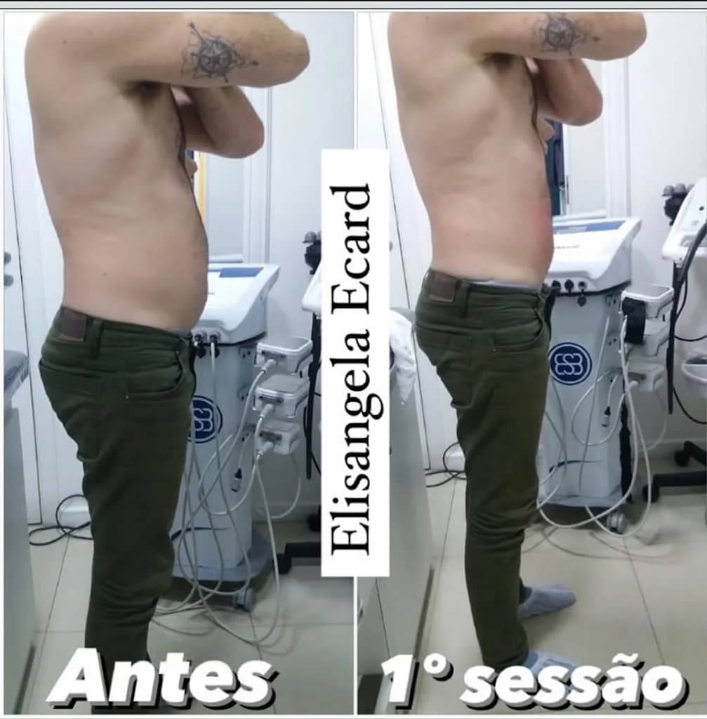 Elisangela Ecard Estética Avançada – foto 2