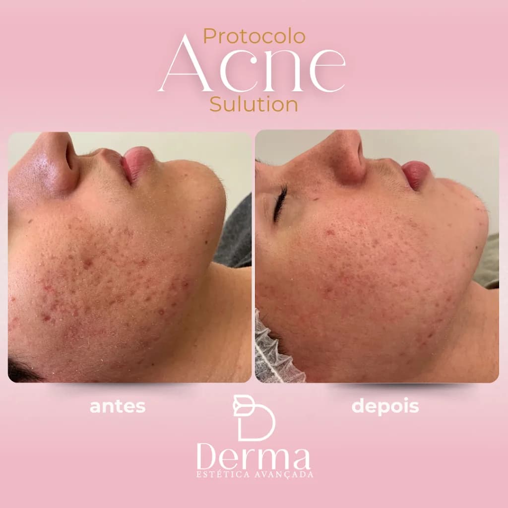 Derma Estética Avançada – foto 3