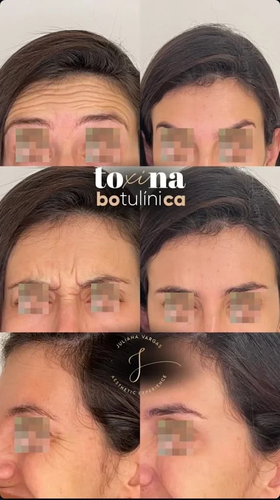 Dra. Juliana Vargas Aesthetic Experience - Botox, Harmonização facial, Preenchimento Labial e Bioestimulador em Rio Grande. – foto 2