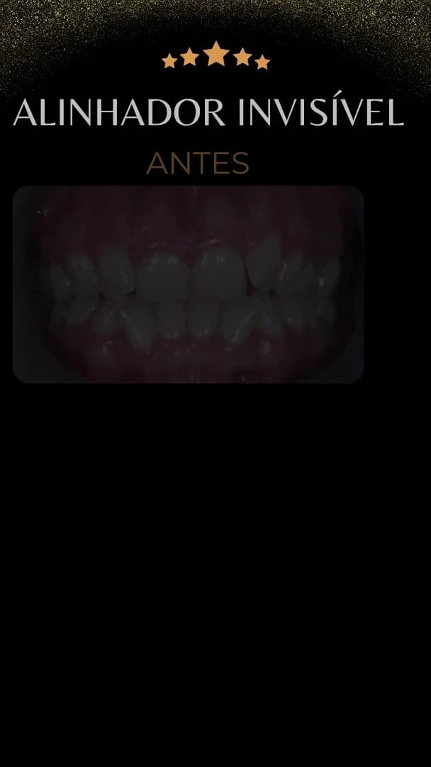 Clínica Bio Odonto | Implante Dentário | Invisalign | Pituba | Salvador - BA – foto 2