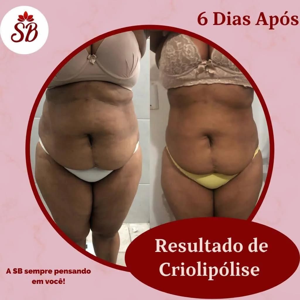 Clinica Sb Estêtica & Pilates – foto 2