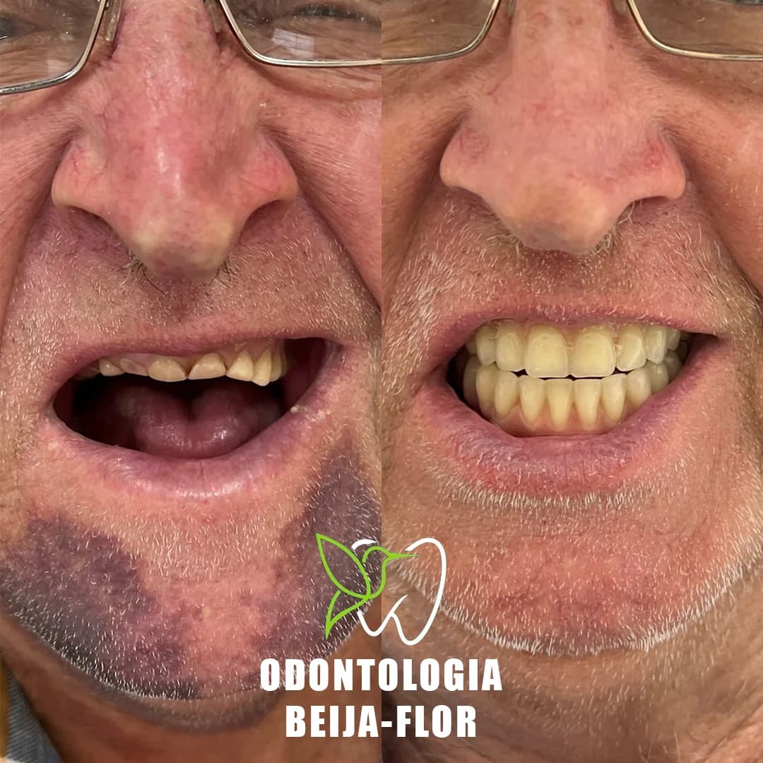 Odontologia Beija-Flor Maringá – foto 3