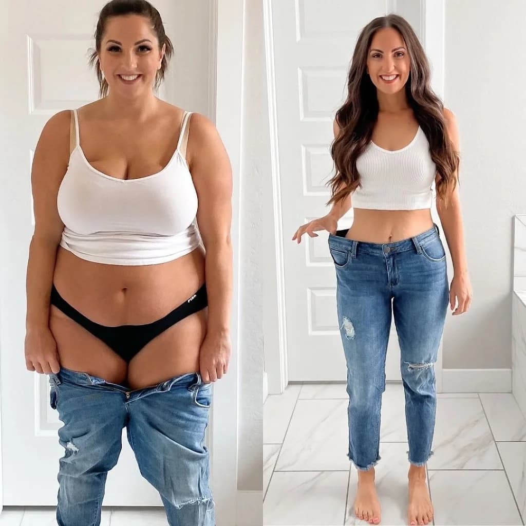 Clínica Pró Estética Perdizes, Ultraformer MPT, Fotona, Gordura Localizada, Botox Facial, Lipo Sem Cortes, Hipro, Liftera – foto 3