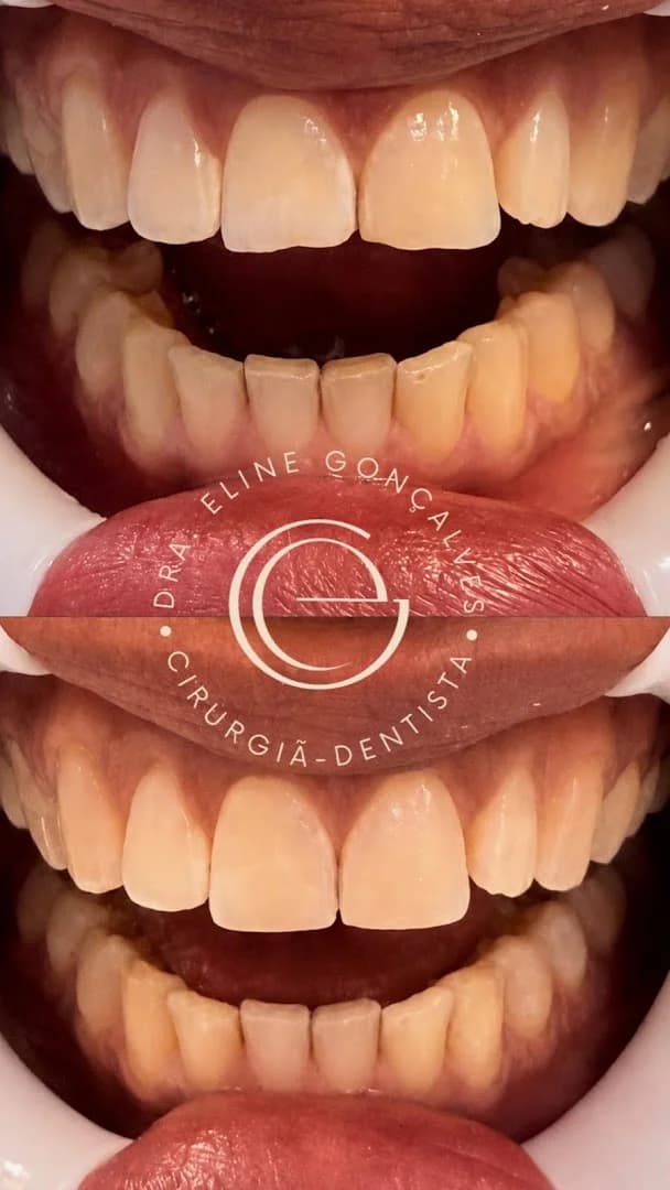 Dra. Eline Gonçalves - Dentista Maceió 24h – foto 1