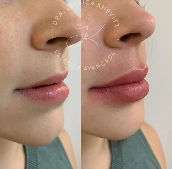 Jéssica Knevitz - Estética Avançada – foto 1