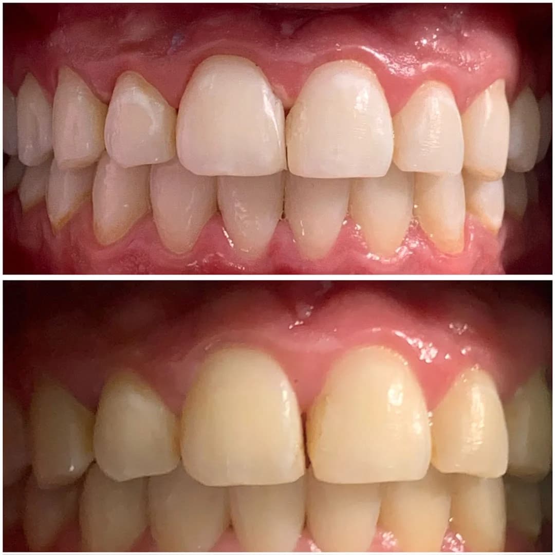 LG Odontologia | Dentista em Uberlândia – foto 2