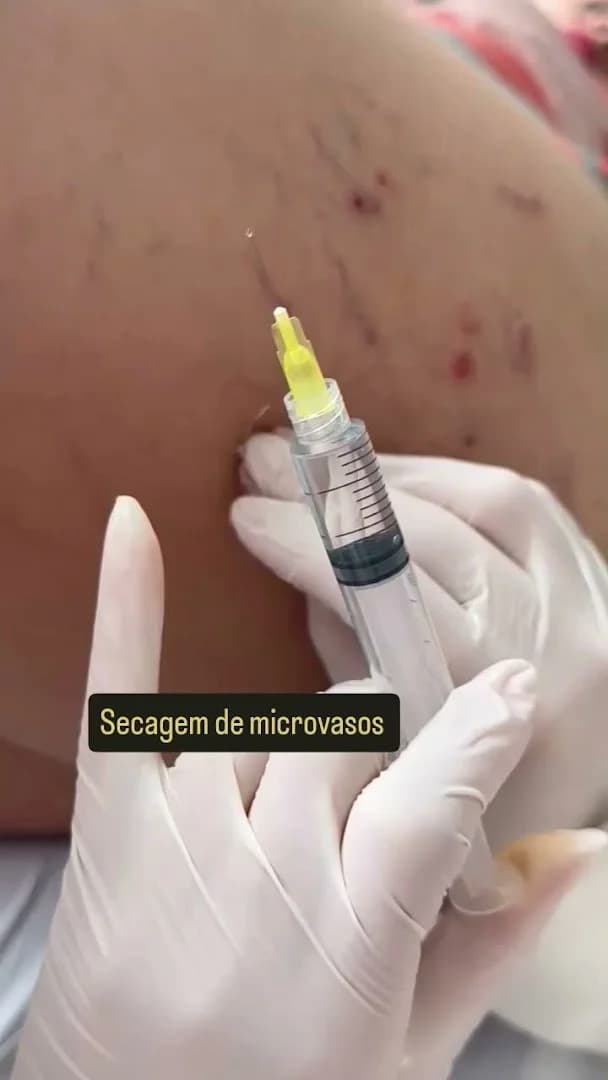 Dra Letícia Gáve - Referência em Harmonização Facial em Cariacica
