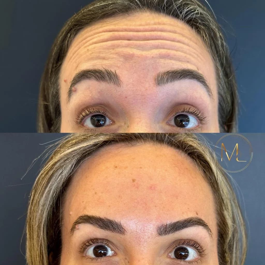 Dra. Michelle Lisboa - Harmonização Facial || Manaus – foto 2