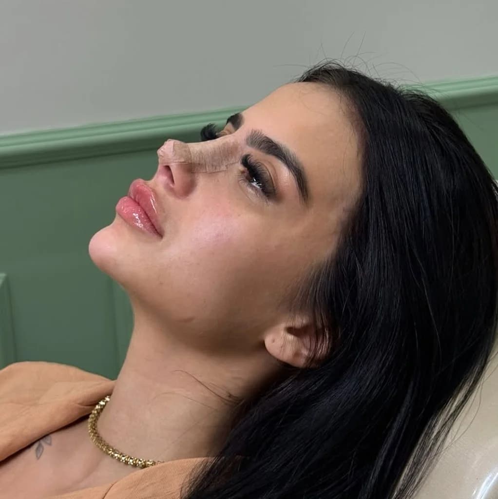 Dra. Paula Oliveira | Harmonização Facial
