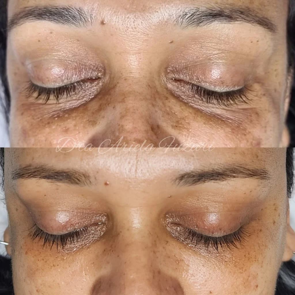 Dra Ariela - Estética Avançada - Harmonização - Lifting não cirúrgico – foto 2