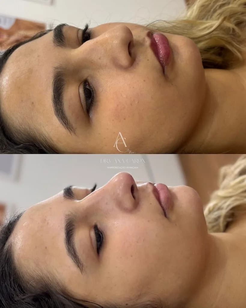 Clinica Dra. Ana Caron - Harmonização Avançada – foto 3