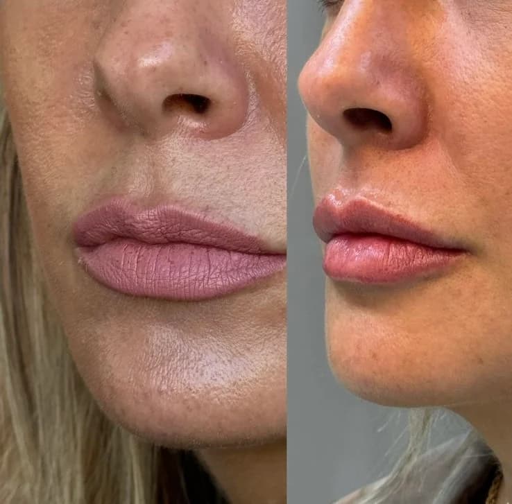 Dra. Alessandra Jereissati / Harmonização Facial – foto 3
