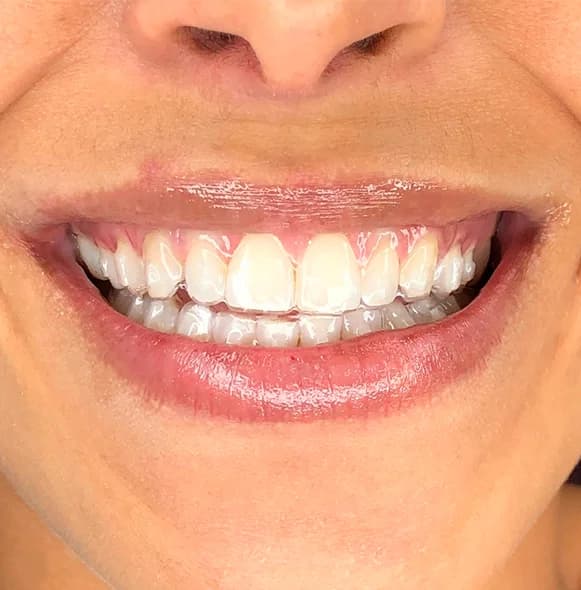 Dentista Dra. Mylla Haag – foto 3