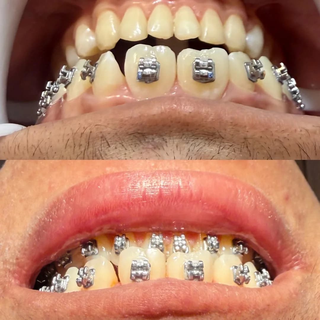 Dra Camila Matos - Dentista em Maceió 24h – foto 3