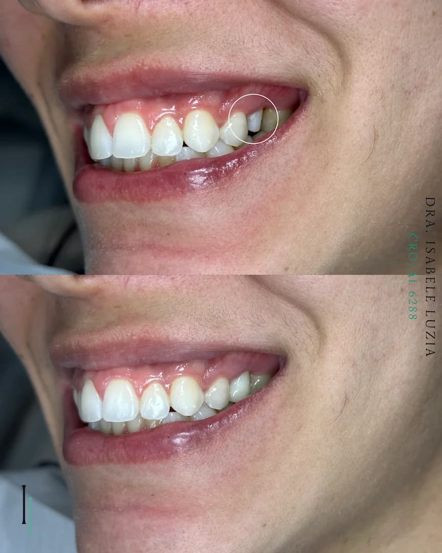 Dra. Isabele Luzia - Prótese dentária e odontologia clínica