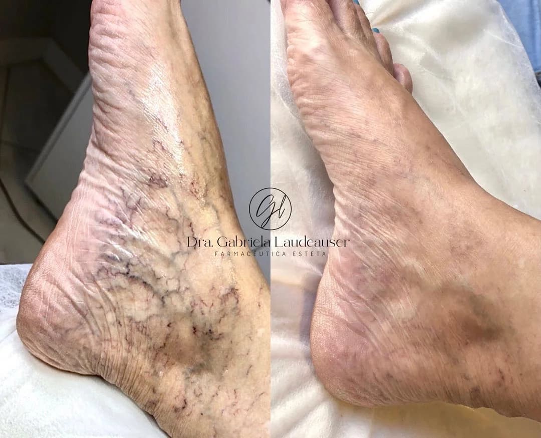 Laudeauser Clinic / Harmonização Facial