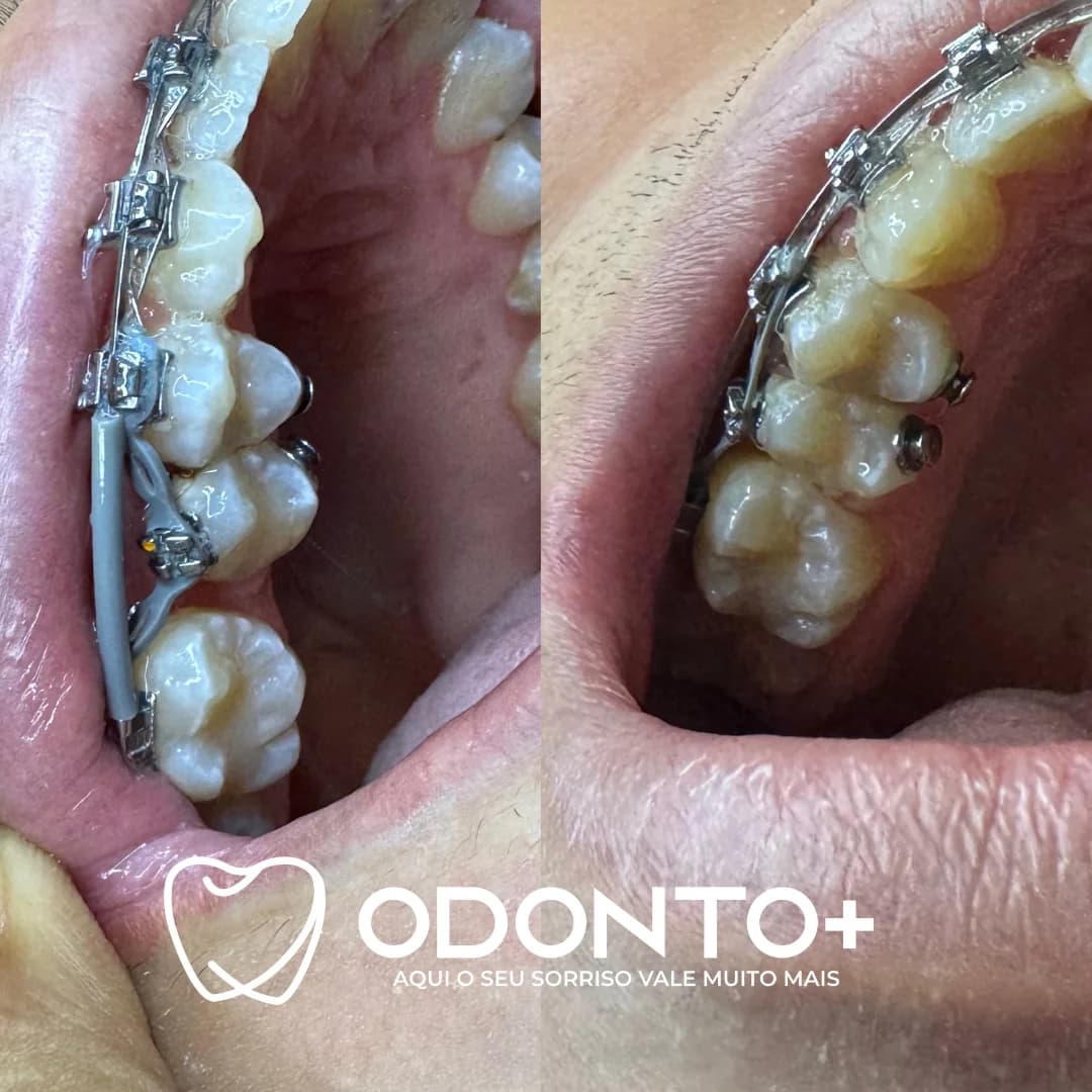 Odonto+ Candeias | Consultório Odontológico – foto 3