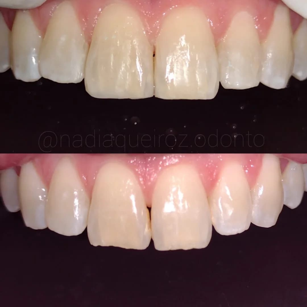 Dra. Nádia Queiroz - Dentista em Sabará - Reabilitação Oral
