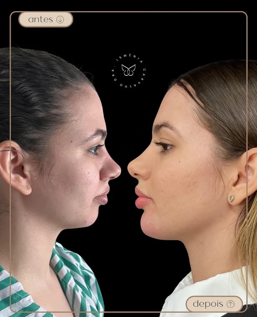 Dra. Ismênia Carvalho | Harmonização Facial e Rinomodelação em Feira de Santana
