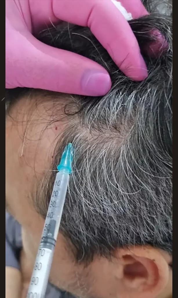 Clinica de Estética Alessandra Peron - Estética facial, Estética corporal, Preenchimentos, Tricologia. – foto 2
