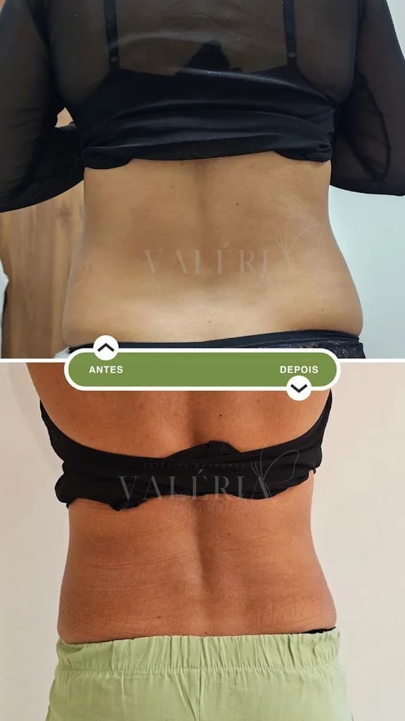 Dra. Valéria Brandão - Estética Avançada em Maceió – foto 1